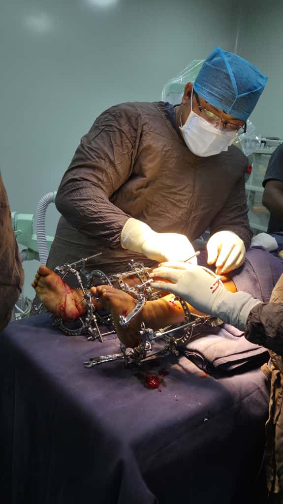 Rings Operation